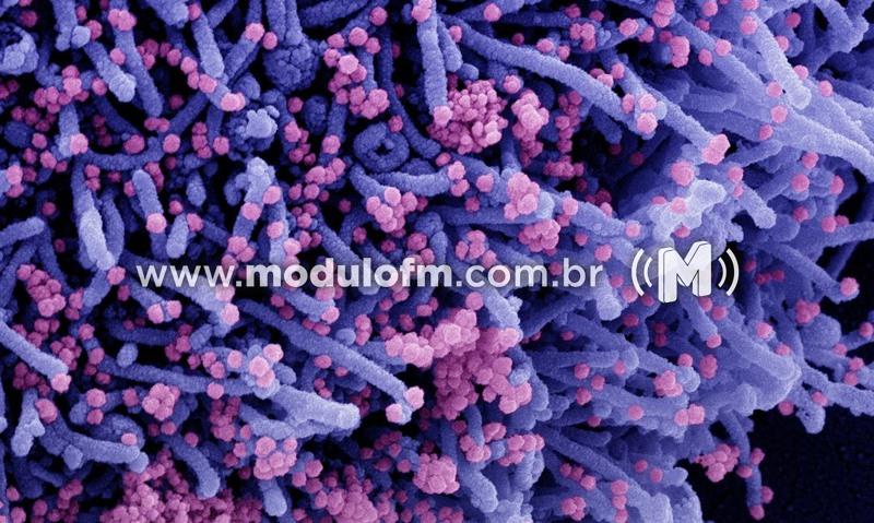 Média móvel de óbitos por covid-19 é a menor desde abril de 2020 no pais