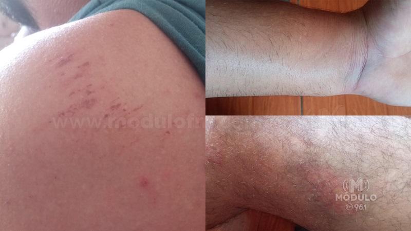 Moradora relata avanço de cães de rua sobre crianças e adultos de bicicleta em Patrocínio; homem teve hematomas